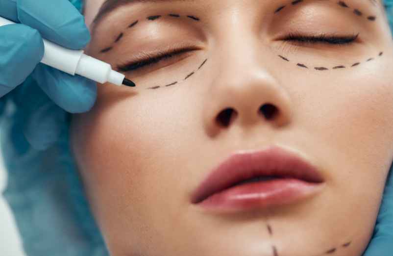 Lipofilling du visage : quels sont les effets secondaires ?