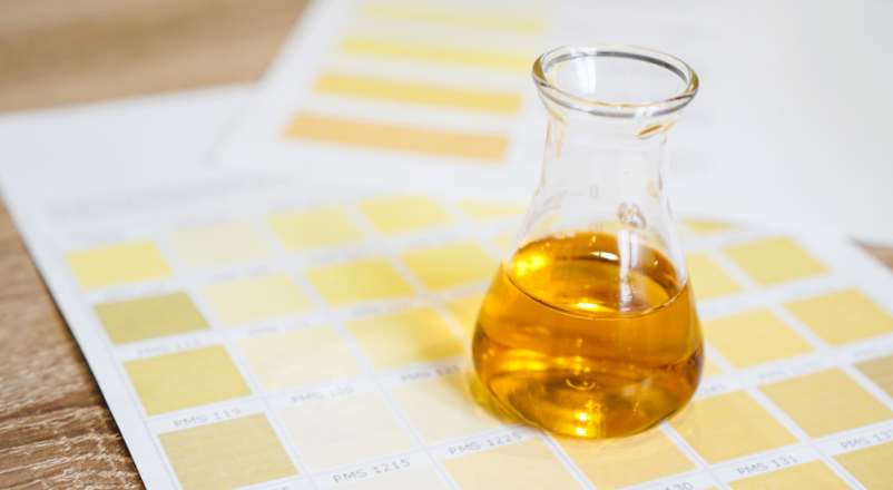 Urine jaune foncé : causes possibles